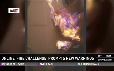 ‘Fire Challenge’: A Dangerous Game You Shouldn’t Play